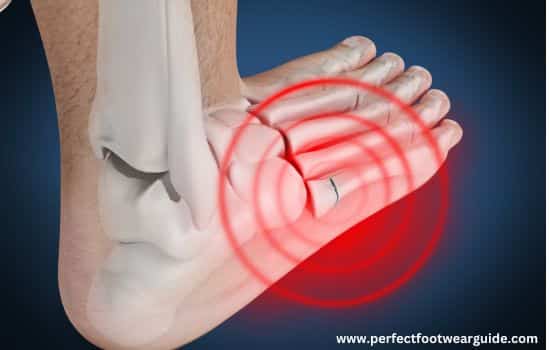What Is A 5th Metatarsal Fracture